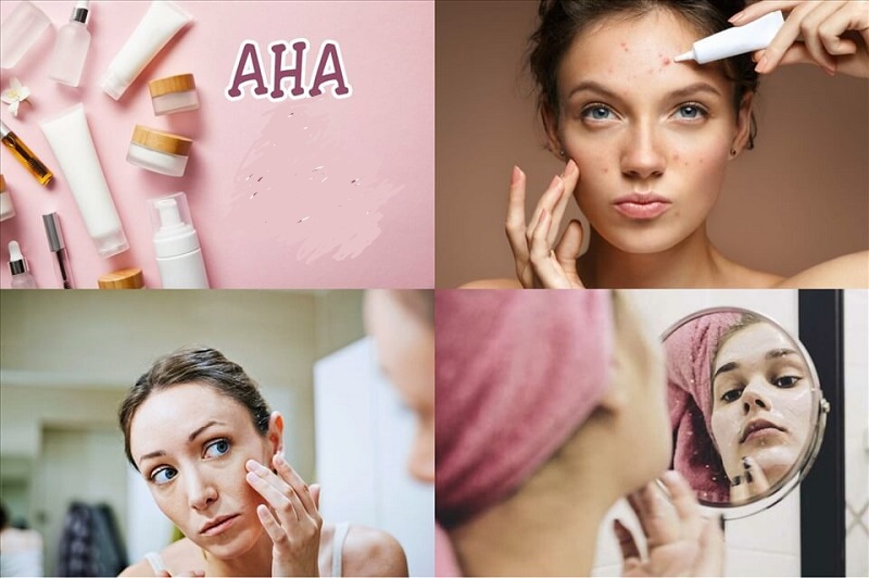 Hỗ trợ trị mụn