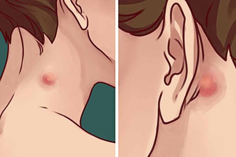 Một số ảnh hưởng nghiêm trọng khi lượng bạch cầu không ổn định