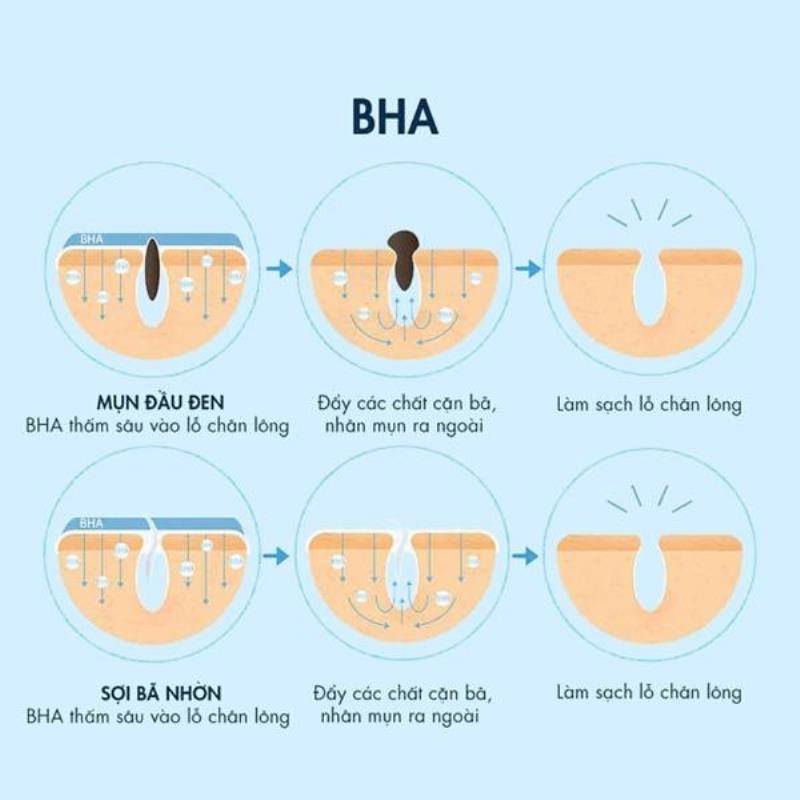 Tìm hiểu BHA là gì