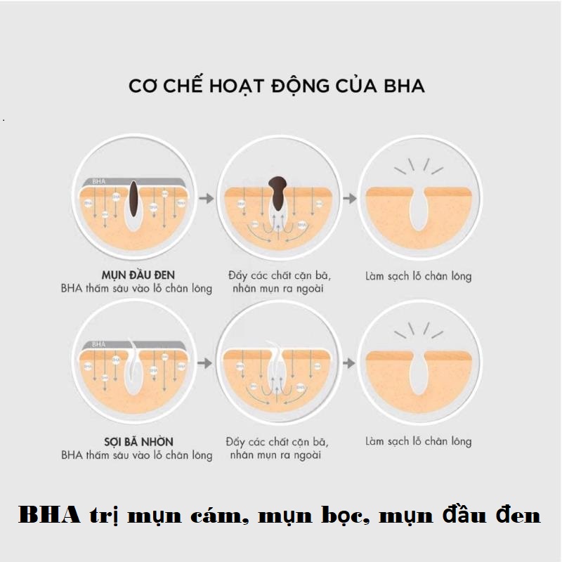 BHA trị mụn cám và mụn bọc hiệu quả