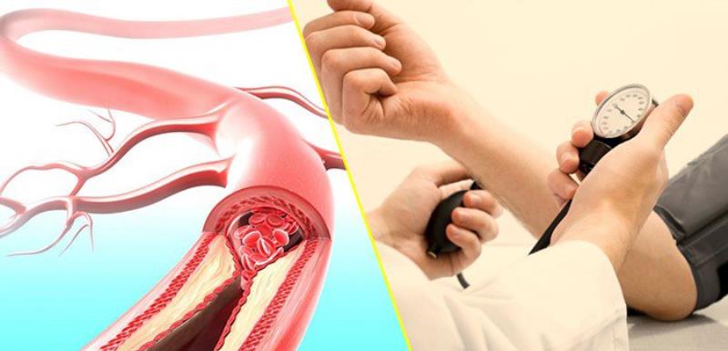 Các tình trạng liên quan tới huyết áp phổ biến