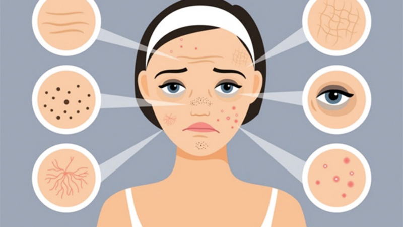 Các vấn đề về da được điều trị