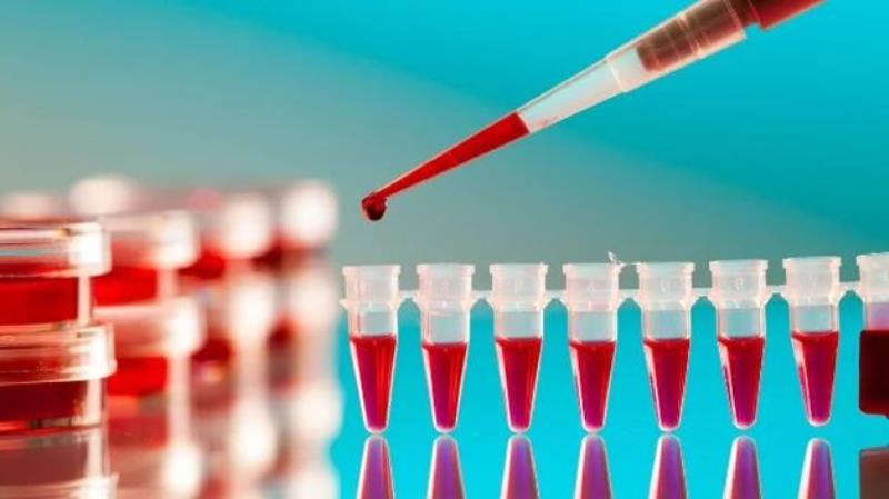 Chi phí làm giấy khám sức khỏe an toàn thực phẩm là bao nhiêu