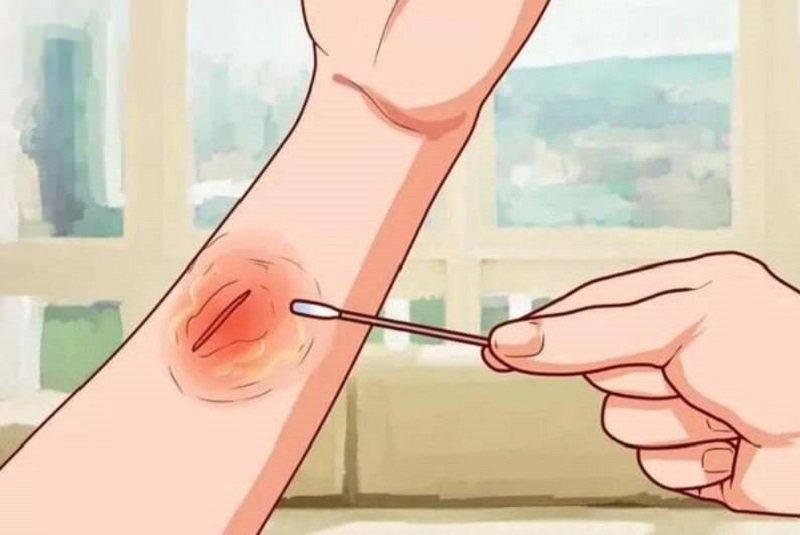 Có khả năng sát khuẩn cao 