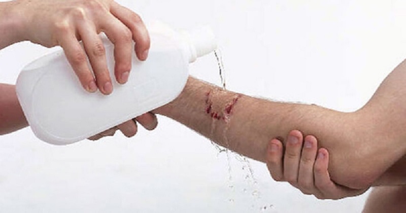 Không được dùng trên những vết thương hở 