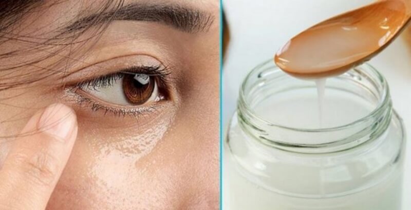 Dầu dừa có tác dụng xóa đi quầng thâm