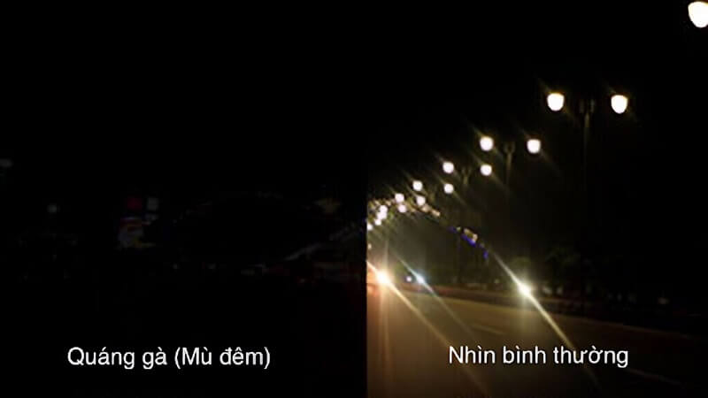 Người quáng gà sẽ bị suy giảm thị lực khi thay đổi ánh sáng