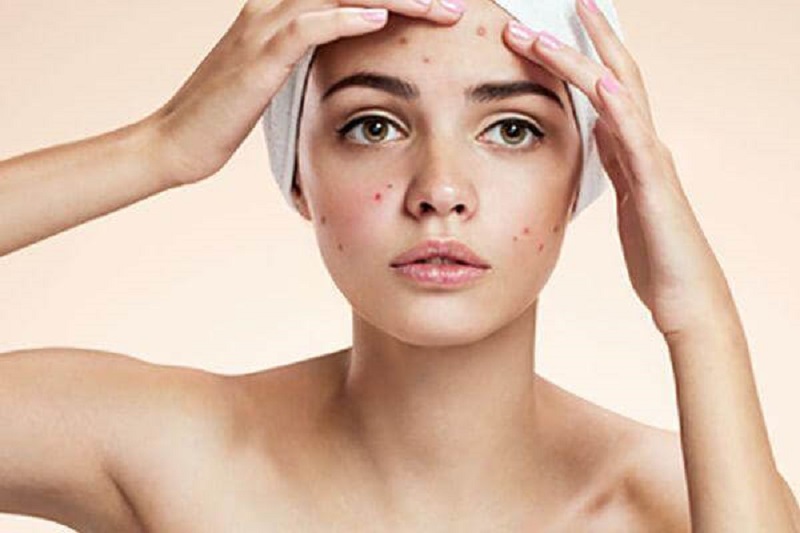 Trường hợp có thể tự điều trị