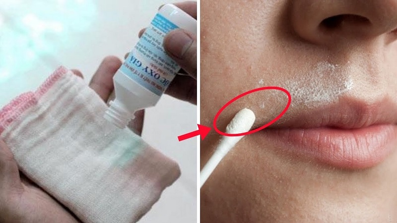 Dùng oxy già trong làm đẹp cũng đem lại tác dụng