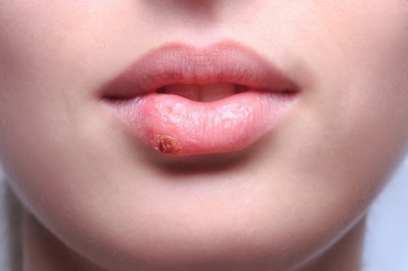 Dùng son hết hạn có sao không?