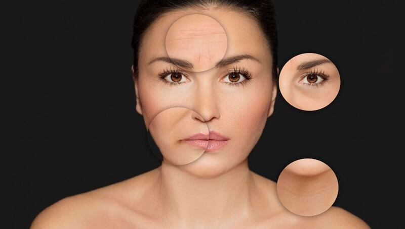 Những vấn đề thắc mắc xoay quanh botox