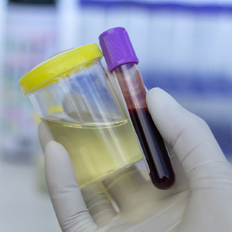 Hình thức kiểm tra doping