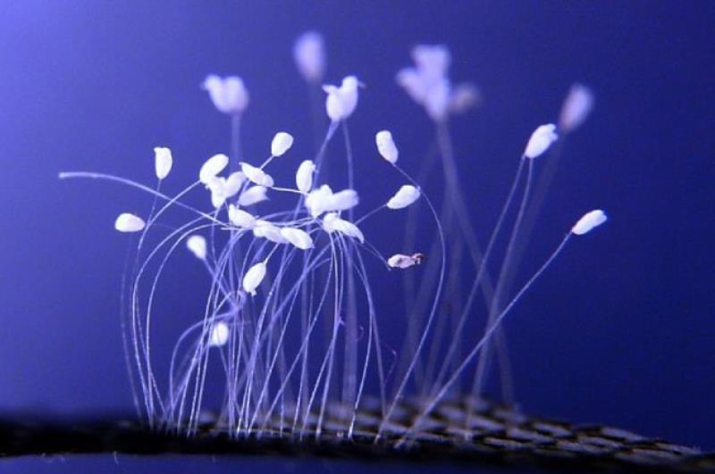 Hoa ưu đàm có ý nghĩa gì