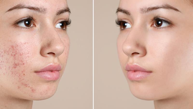 Húng lủi giúp làn da sáng khỏe