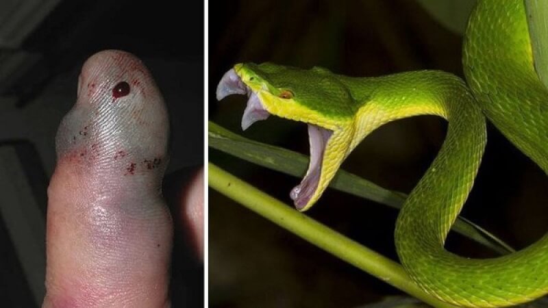 Ổn định tinh thần nạn nhân sau khi bị cắn