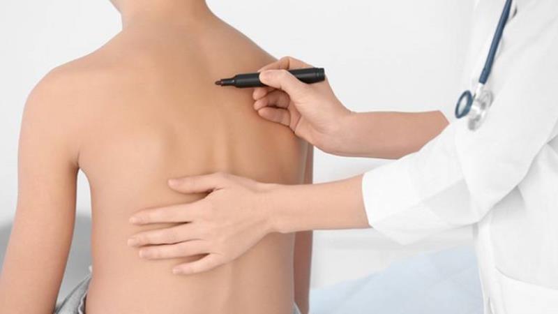 Kiểm tra để phát hiện kịp thời tình trạng cong vẹo cột sống