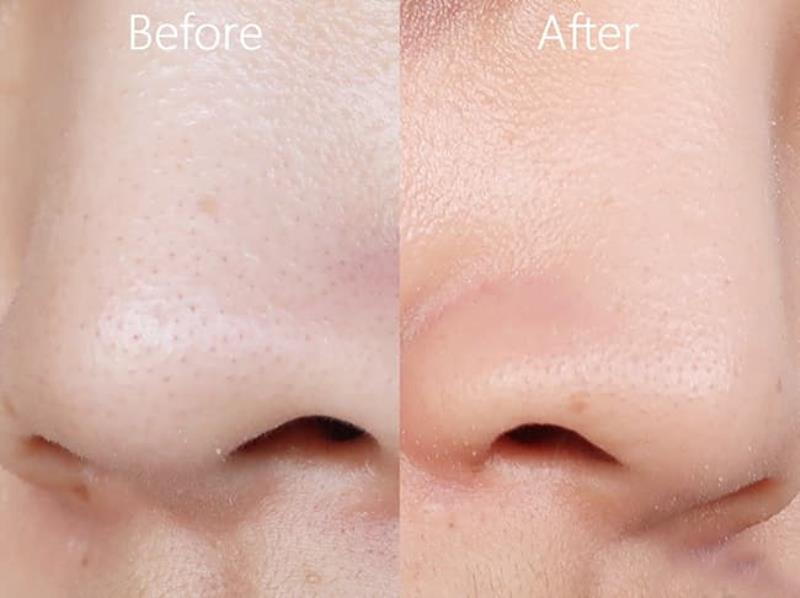 Bùn khoáng làm sạch da hiệu quả