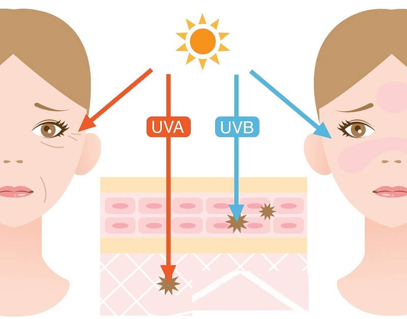 Tia UV có thể gây lão hóa da