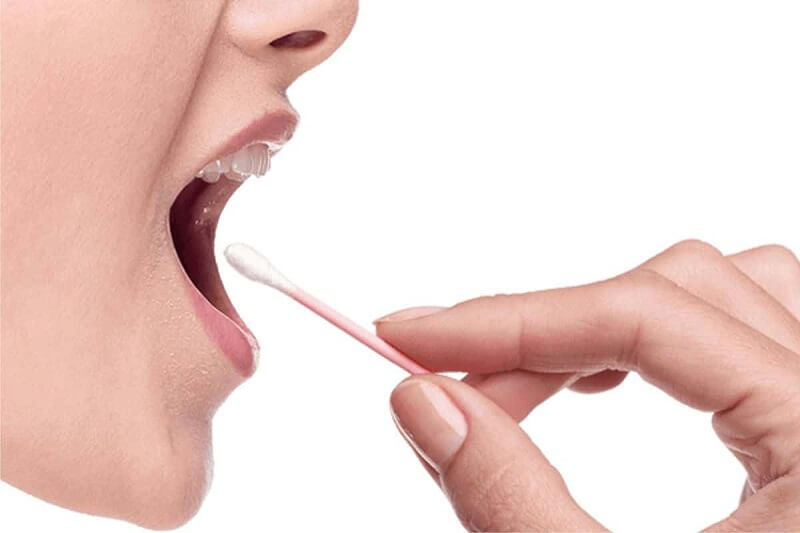 Cần lấy mẫu đúng cách để kết quả xét nghiệm được chính xác