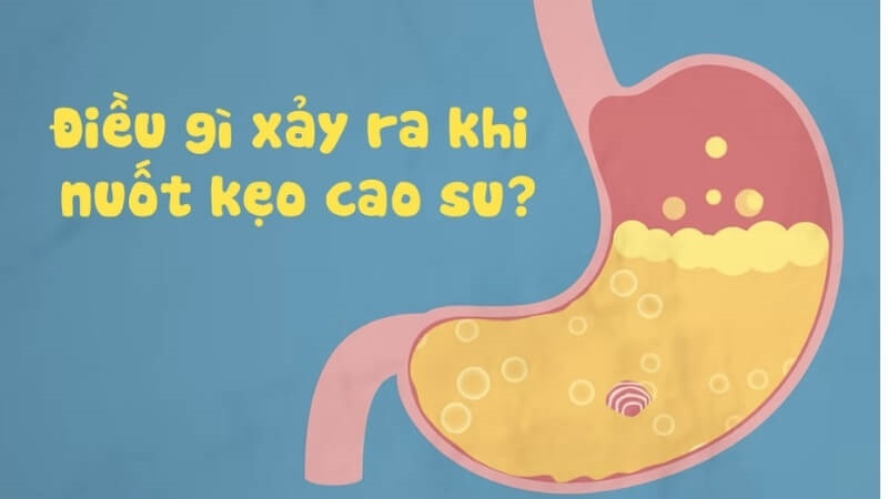 Dạ dày tiêu hoá kẹo cao su như thế nào?