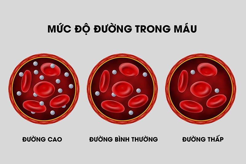 Lượng đường trong máu tăng cao