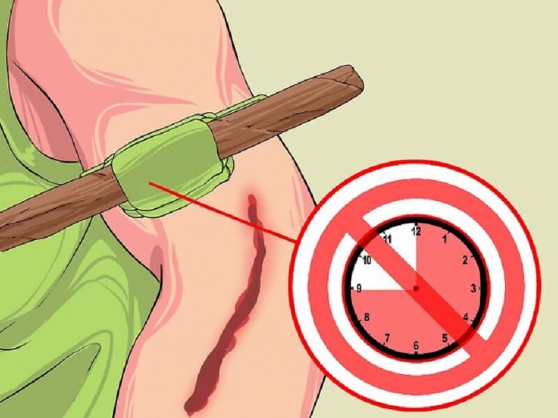 Mỗi lần nới lỏng garô cách nhau khoảng 30 phút