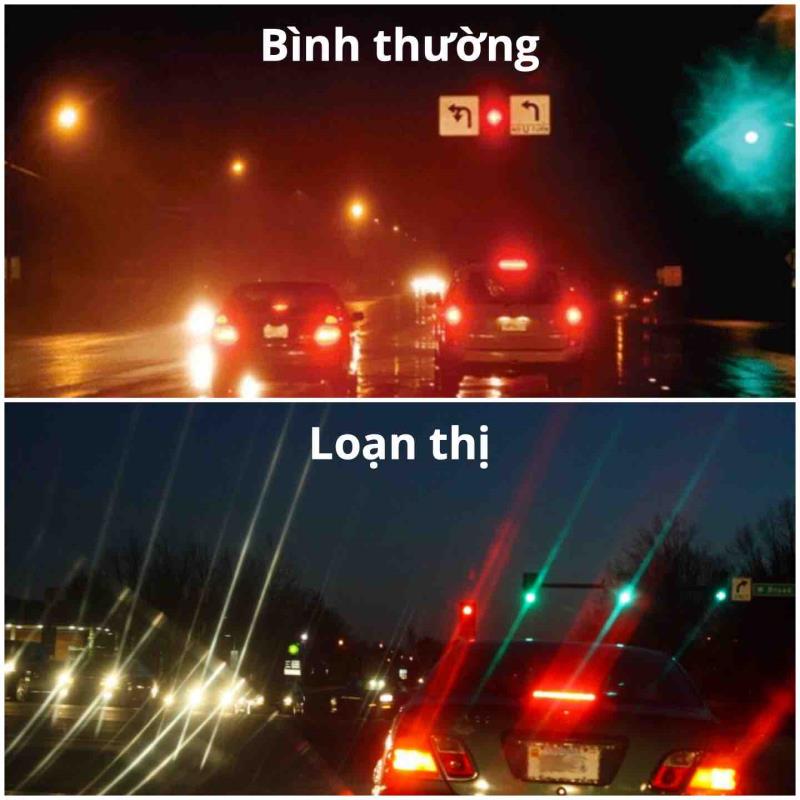 Tìm hiểu loạn thị là gì