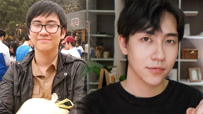 Trường hợp nên và không nên mewing