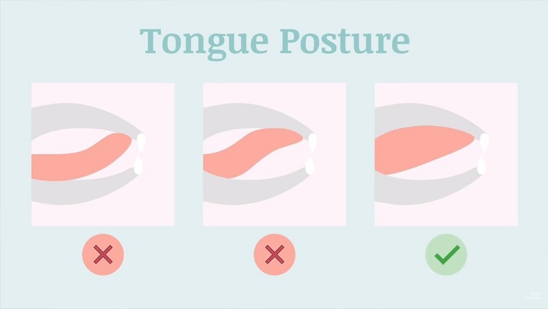 Lỗi sai khi tập mewing