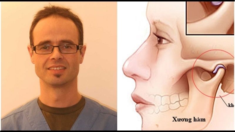 Lợi ích khi luyện tập mewing