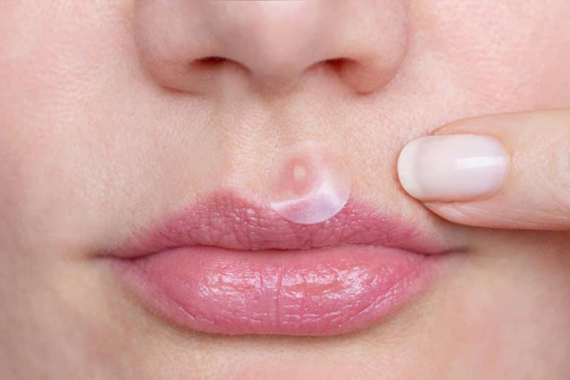 Miếng dán mụn có thành phần khá an toàn