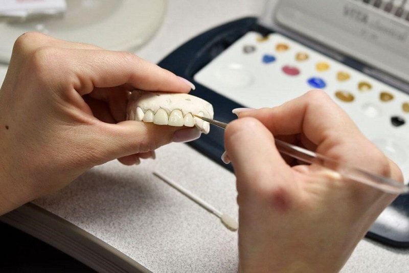 Ngành kỹ thuật phục hình răng là gì?