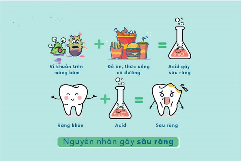 Sự phát triển của sâu răng