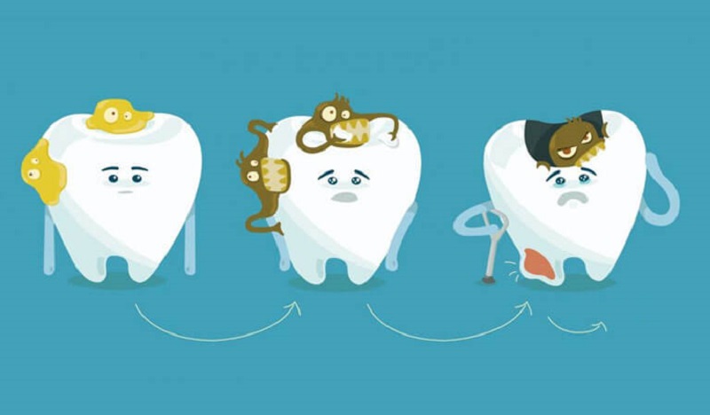 Nguyên nhân làm tăng nguy cơ sâu răng