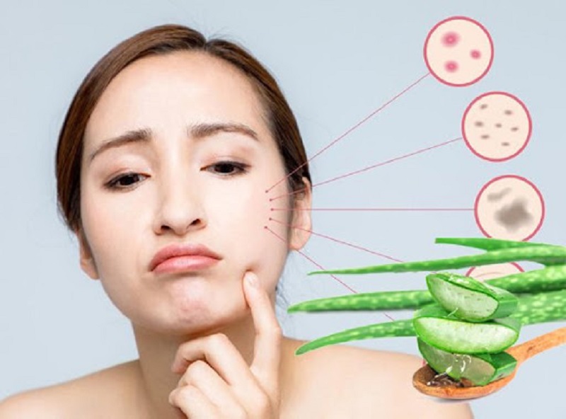 Se khít lỗ chân lông