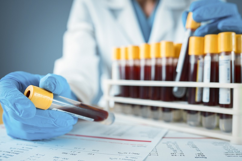 Nhóm máu AB thường có đặc điểm sức khỏe như thế nào