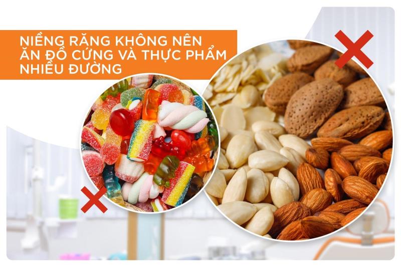 Những thực phẩm nên kiêng khi niềng răng