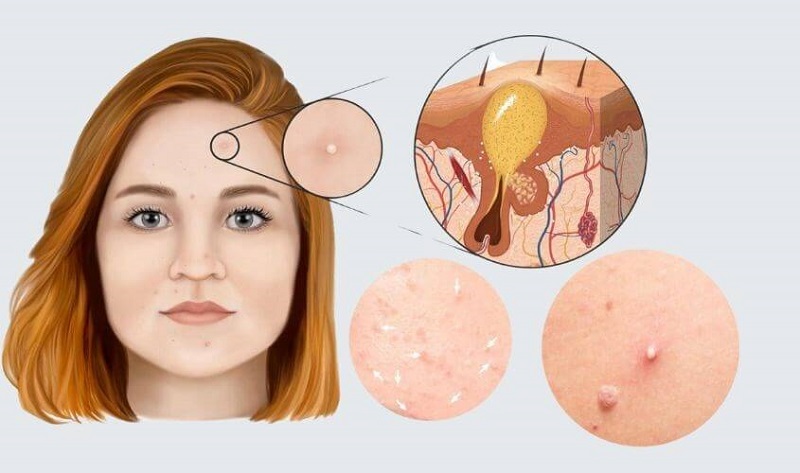 Bạn đang gặp vấn đề về nội tiết