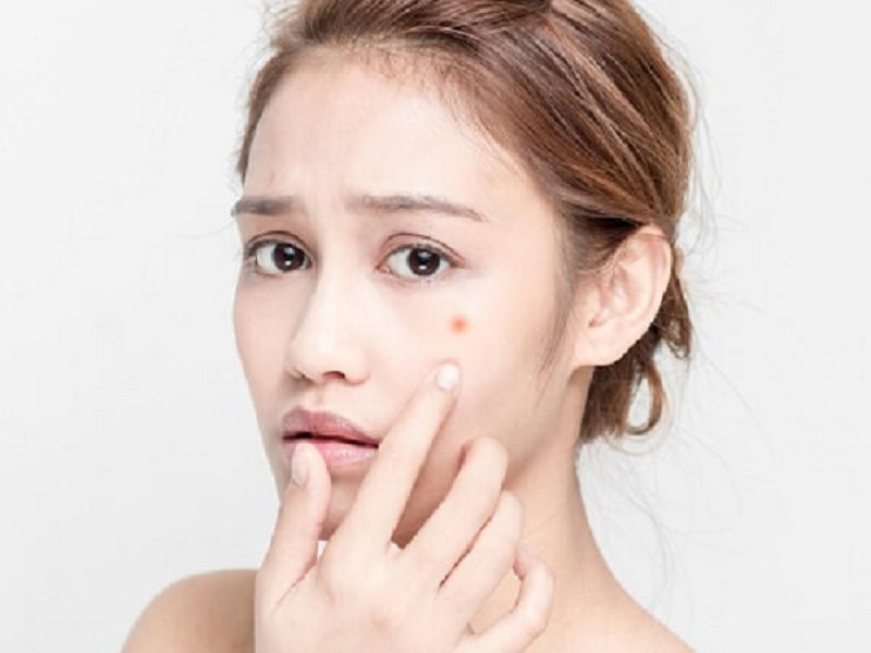 Các thành phần được sử dụng trong peel da