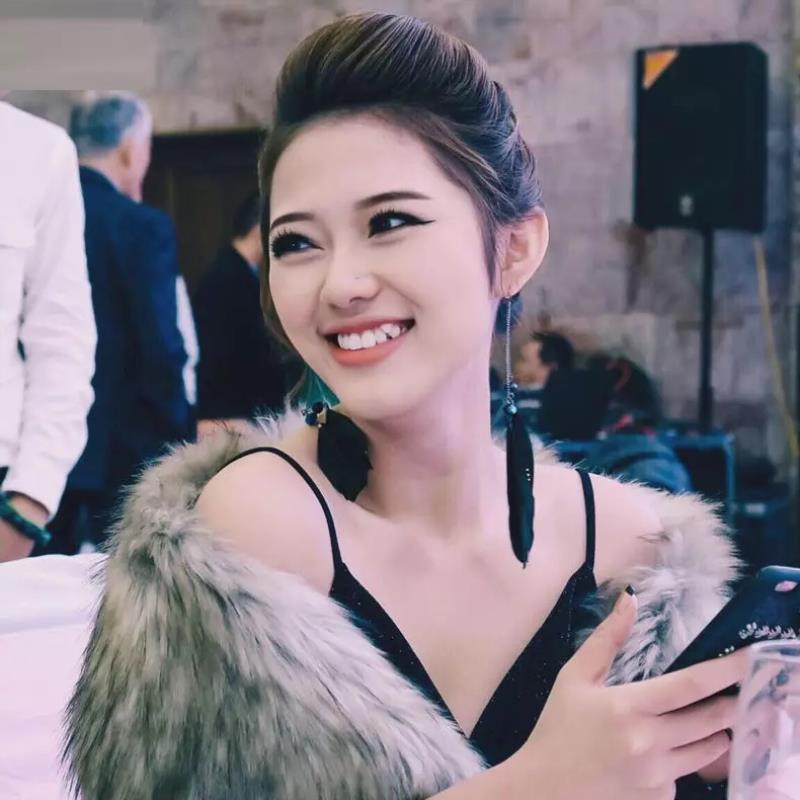 Răng khểnh đẹp tạo sự duyên dáng và dễ thương cho chủ nhân