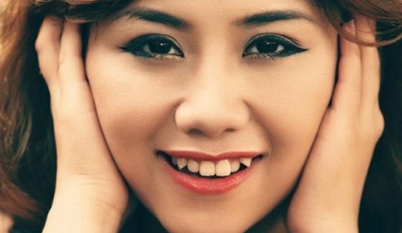 Răng khểnh theo Y học gây ảnh hưởng tới chức năng ăn nhai