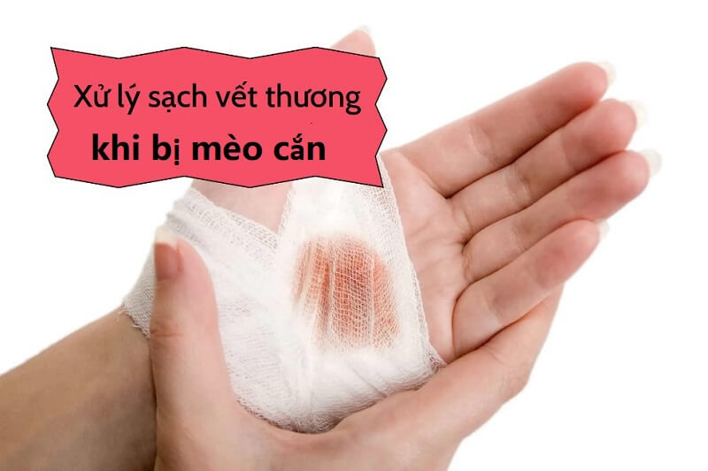 Sơ cứu vết thương nếu bị mèo cào