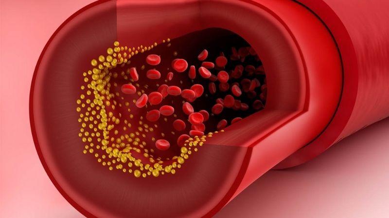Nồng độ cholesterol xấu giảm đi