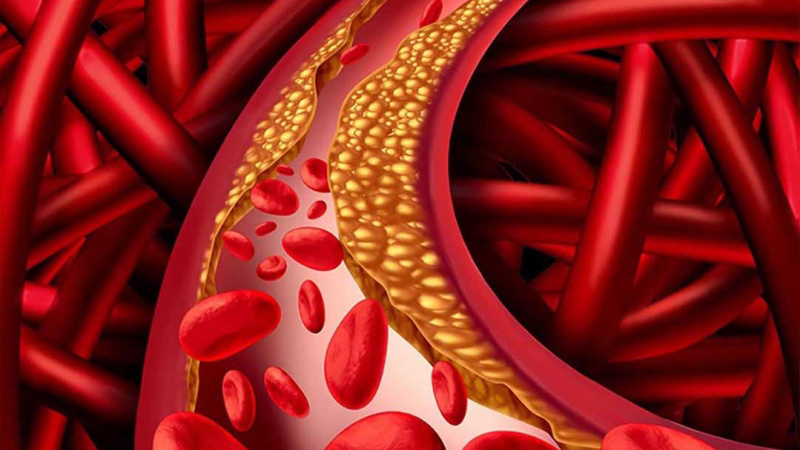 Hạ cholesterol máu và tốt cho người giảm cân