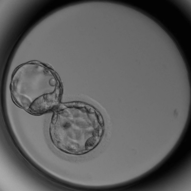 Tế bào gốc phai tìm thấy tại phôi thai 3-5 ngày tuổi