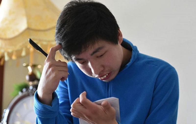 Các dạng thiểu năng trí tuệ