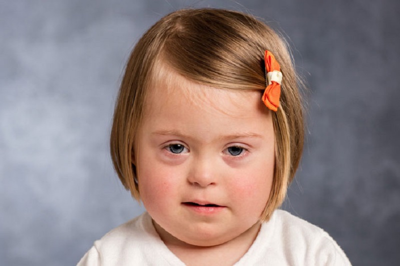 Thiểu năng là gì