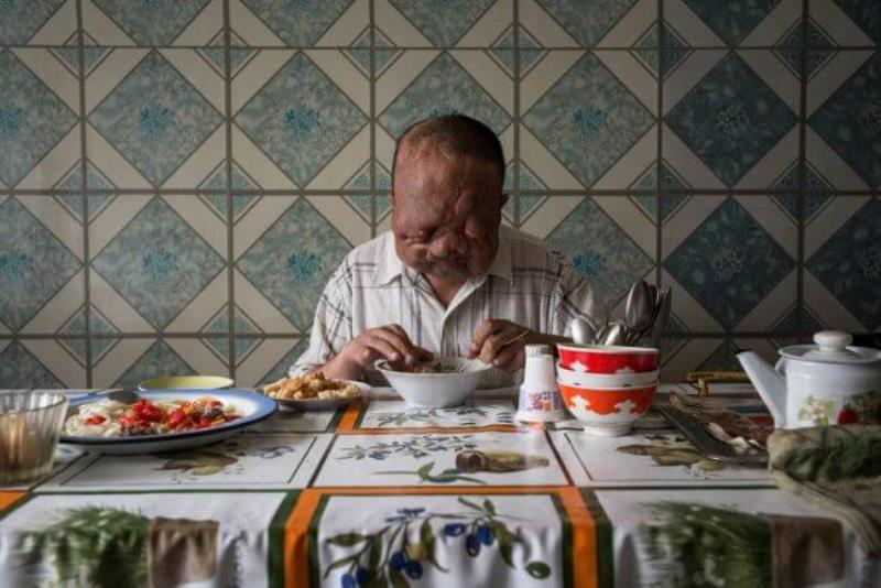 Thử nghiệm về bức xạ chữa ung thư