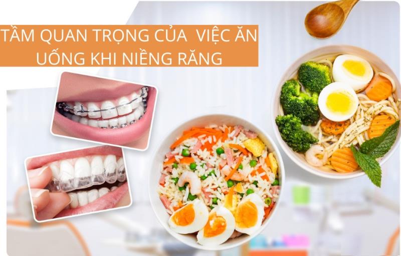 Niềng răng nên lựa chọn các thực phẩm phù hợp