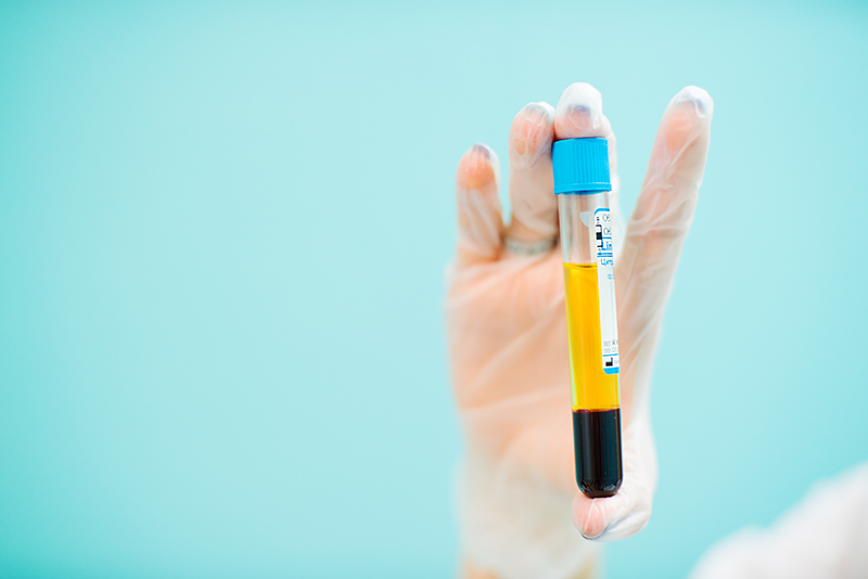 Tìm hiểu chung về huyết tương